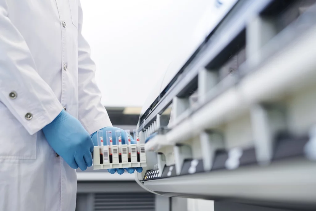 Analisi biologica per valutare l’esposizione professionale a sostanze pericolose