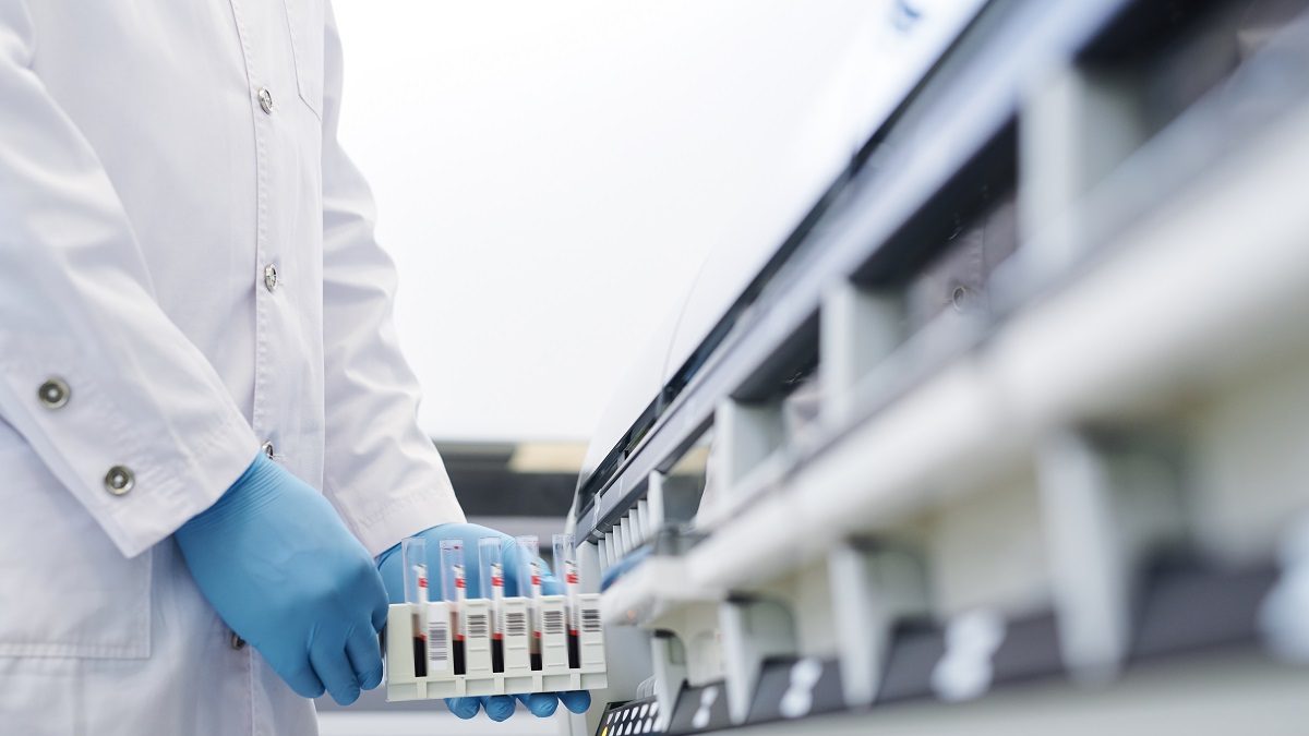 Analisi biologica per valutare l’esposizione professionale a sostanze pericolose