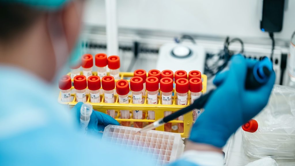 Operatore sanitario esegue prelievo di sangue per il biomonitoraggio dei lavoratori esposti al piombo.