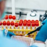 Operatore sanitario esegue prelievo di sangue per il biomonitoraggio dei lavoratori esposti al piombo.